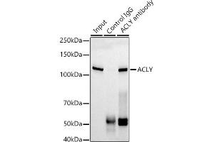 Immunoprecipitation analysis of 300 μg extracts of HepG2 cells using 3 μg ACLY antibody (ABIN1678575, ABIN7101559, ABIN7101560 and ABIN7101561). (ACLY 抗体)