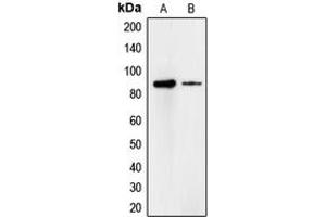 Western blot analysis of Cadherin 18 expression in A549 (A), HeLa (B) whole cell lysates. (CDH18 抗体  (Center))