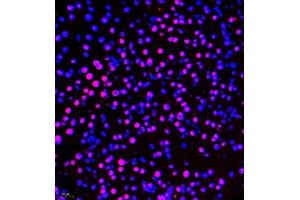 Immunofluorescence (Paraffin-embedded Sections) (IF (p)) image for anti-Zinc Finger Protein 106 Homolog (ZFP106) antibody (ABIN7076260)