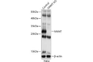 Western blot analysis of extracts of various cell lines, using NNMT antibody (ABIN7268908) at 1:500 dilution.