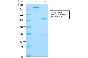 SDS-PAGE Analysis Purified Tenascin C Rabbit Recombinant Monoclonal Antibody (TNC/2981R). (Recombinant TNC 抗体)