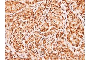 IHC-P Image Immunohistochemical analysis of paraffin-embedded A549 xenograft, using MID1IP1, antibody at 1:100 dilution. (m1ip1 抗体)