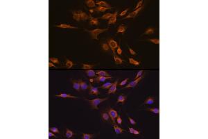 Immunofluorescence analysis of C6 cells using CNTF Rabbit pAb (ABIN3015704, ABIN3015705, ABIN3015706 and ABIN6219054) at dilution of 1:100 (40x lens). (CNTF 抗体  (AA 1-200))