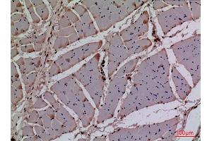 Immunohistochemical analysis of paraffin-embedded rat muscle, antibody was diluted at 1:100. (CDK4 抗体  (N-Term))