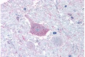 Anti-MRGPRD antibody  ABIN1049069 IHC staining of human brain, medulla. (MRGPRD 抗体  (Cytoplasmic Domain))