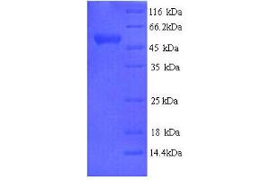 SDS-PAGE (SDS) image for Arylsulfatase B (ARSB) (AA 37-533) protein (His tag) (ABIN5713258) (Arylsulfatase B Protein (ARSB) (AA 37-533) (His tag))