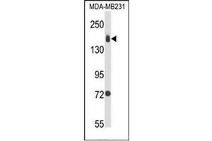 Western blot analysis of CD49b / ITGA2 Antibody (C-term) in MDA-MB231 cell line lysates (35ug/lane). (ITGA2 抗体  (C-Term))