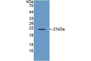 Detection of Recombinant RSPO1, Rat using Polyclonal Antibody to R-Spondin 1 (RSPO1) (RSPO1 抗体  (AA 136-262))