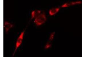 ABIN6275436 staining Hela cells by IF/ICC. (RAB3GAP2 抗体  (Internal Region))