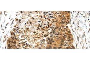 Immunohistochemistry (Paraffin-embedded Sections) (IHC (p)) image for anti-Nuclear Receptor Subfamily 2, Group F, Member 2 (NR2F2) antibody (ABIN7244288)