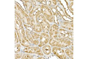 Immunohistochemistry of paraffin-embedded rat ovary using DNA Ligase III/LIG3 Rabbit pAb (ABIN6130288, ABIN6143207, ABIN6143208 and ABIN6217532) at dilution of 1:50 (40x lens). (LIG3 抗体  (AA 730-1009))