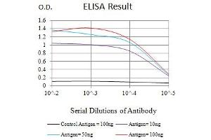 Black line: Control Antigen (100 ng),Purple line: Antigen (10 ng), Blue line: Antigen (50 ng), Red line:Antigen (100 ng) (KRT20 抗体  (AA 1-150))