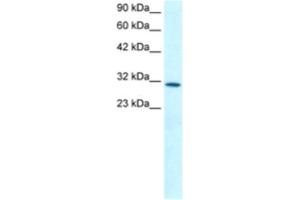 Western Blotting (WB) image for anti-Kruppel-Like Factor 8 (KLF8) antibody (ABIN2460245) (KLF8 抗体)