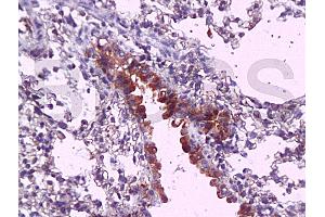 Formalin-fixed and paraffin embedded mouse lung tissue labeled with Anti-MyD88 Polyclonal Antibody, Unconjugated (ABIN736881) at 1:200, followed by conjugation to the secondary antibody and DAB staining (MYD88 抗体  (AA 201-296))