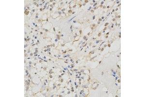 Immunohistochemistry (IHC) image for anti-Mismatch Repair Protein 2 (MSH2) (AA 1-300) antibody (ABIN3021477)