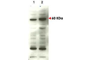 Western blot using SMAD4 polyclonal antibody  to detect over-expressed SMAD4 in transfected COS cells (lane 2). (SMAD4 抗体  (C-Term))