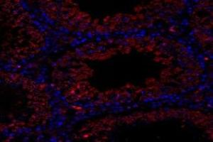 Immunofluorescence (fixed cells) (IF/ICC) image for anti-omega-3 Fatty Acid Receptor 1 (O3FAR1) antibody (ABIN7074942)