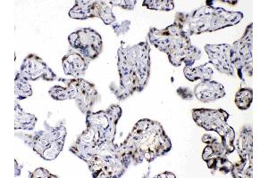 IHC analysis of DBI using anti-DBI antibody . (Diazepam Binding Inhibitor 抗体  (AA 2-87))