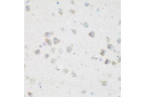 Immunohistochemistry of paraffin-embedded mouse brain using NFU1 antibody at dilution of 1:200 (40x lens). (NFU1 抗体)