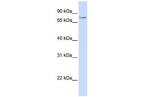 SYDE1 antibody used at 1 ug/ml to detect target protein.
