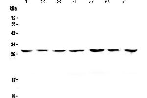 Western blot analysis of 14-3-3 zeta/delta using anti-14-3-3 zeta/delta antibody . (14-3-3 zeta 抗体)