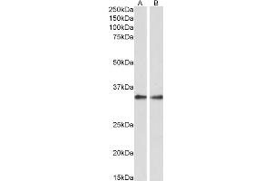 ABIN570988 (0. (PPP4C 抗体  (C-Term))