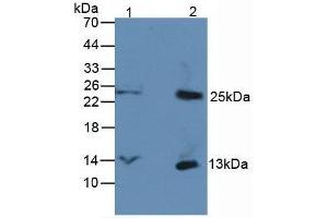 Western blot analysis of (1) Rat Serum Tissue, and (2) Rat Spleen Tissue, using Rabbit Anti-Human bTG Antibody (3 µg/ml) and HRP-conjugated Rabbit Anti-Mouse antibody ( (beta-Thromboglobulin 抗体  (AA 59-128))