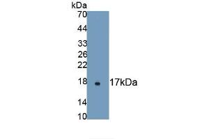 Detection of Recombinant aHSP, Human using Monoclonal Antibody to Alpha-Hemoglobin Stabilizing Protein (aHSP) (aHSP 抗体  (AA 1-102))