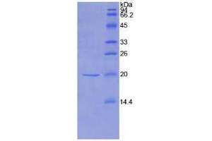SDS-PAGE analysis of Mouse NME1 Protein. (NME1 蛋白)