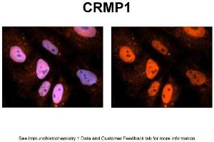 Sample Type: NT2 cells Red: Antibody Blue: DAPI Primary Dilution: 1ug/50ul antibody Secondary Antibody: Alexa goat anti-rabbit 594 Image Submitted by: Yuzhi Chen, University of Arkansas for Medical Sciences (CRMP1 抗体  (N-Term))