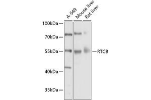 Western blot analysis of extracts of various cell lines, using RTCB Antibody (ABIN6127939, ABIN6147287, ABIN6147288 and ABIN6214508) at 1:1000 dilution. (C22orf28 抗体  (AA 236-505))