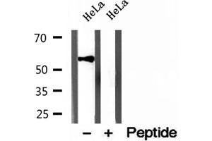 Western blot analysis of extracts of HeLa cells, using KMO antibody. (KMO 抗体  (Internal Region))