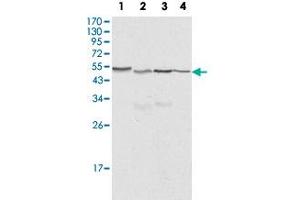 Western blot analysis of CALR monoclonal antibody, clone 1G6A7  against HeLa (1), A-549 (2), NTERA2 (3) and MCF-7 (4) cell lysate. (Calreticulin 抗体)
