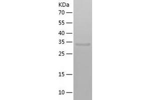 Western Blotting (WB) image for Ornithine Carbamoyltransferase (OTC) (AA 33-354) protein (His tag) (ABIN7285308) (OTC Protein (AA 33-354) (His tag))