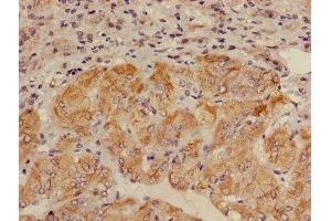 Immunohistochemistry of paraffin-embedded human adrenal gland tissue using ABIN7143672 at dilution of 1:100 (ALDH3B2 抗体  (AA 57-311))