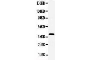Anti-Serum Amyloid P Picoband antibody,  All lanes: Anti-Serum Amyloid P at 0. (APCS 抗体  (AA 21-224))