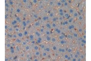 Detection of MUSK in Mouse Liver Tissue using Polyclonal Antibody to Muscle, Skeletal, Receptor Tyrosine Kinase (MUSK) (MUSK 抗体  (AA 517-777))