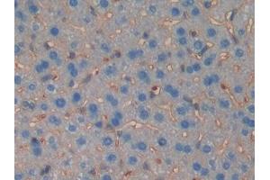 Detection of MUSK in Mouse Liver Tissue using Polyclonal Antibody to Muscle, Skeletal, Receptor Tyrosine Kinase (MUSK) (MUSK 抗体  (AA 517-777))