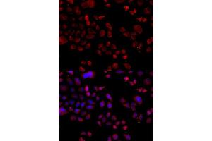 Immunofluorescence analysis of A549 cells using SLC22A11 antibody (ABIN5975730). (SLC22A11 抗体)