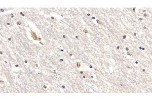 Detection of IL18R1 in Human Cerebrum Tissue using Monoclonal Antibody to Interleukin 18 Receptor 1 (IL18R1) (IL18R1 抗体  (AA 375-428))