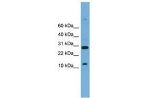 Image no. 1 for anti-T-Cell Acute Lymphocytic Leukemia 2 (TAL2) (AA 51-100) antibody (ABIN6744552) (TAL2 抗体  (AA 51-100))