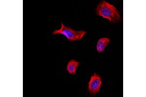 ABIN6265428 and ABIN6266799 staining Hela by IF/ICC.