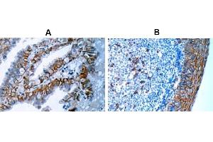 Immunohistochemistry (IHC) image for anti-Syndecan 1 (SDC1) antibody (ABIN487501) (Syndecan 1 抗体)