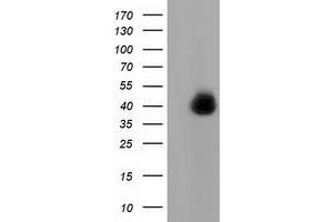 HEK293T cells were transfected with the pCMV6-ENTRY control (Left lane) or pCMV6-ENTRY FAM84B (Right lane) cDNA for 48 hrs and lysed. (FAM84B 抗体)