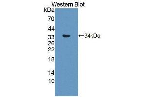 Western blot analysis of the recombinant protein. (Phospholipase C delta 3 抗体  (AA 528-789))