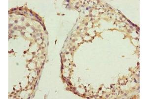 Immunohistochemistry of paraffin-embedded human testis tissue using ABIN7157234 at dilution of 1:100 (KANSL3 抗体  (AA 1-200))