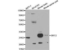 Western blot analysis of extracts of various cell lines, using SIRT2 antibody. (SIRT2 抗体  (AA 288-389))