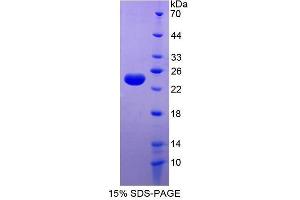 SDS-PAGE (SDS) image for Ferritin, Light Polypeptide (FTL) (AA 2-175) protein (His tag) (ABIN3209934) (FTL Protein (AA 2-175) (His tag))