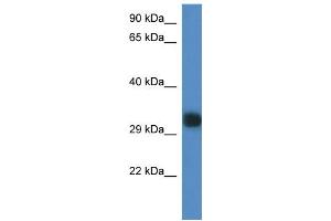 WB Suggested Anti-Gm527 Antibody Titration: 1. (GM527 抗体  (C-Term))