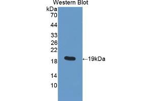 Detection of Recombinant PDIA5, Human using Polyclonal Antibody to Protein Disulfide Isomerase A5 (PDIA5) (PDIA5 抗体  (AA 378-506))